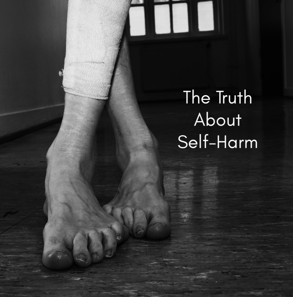 Glamorizing Our Self-Harm